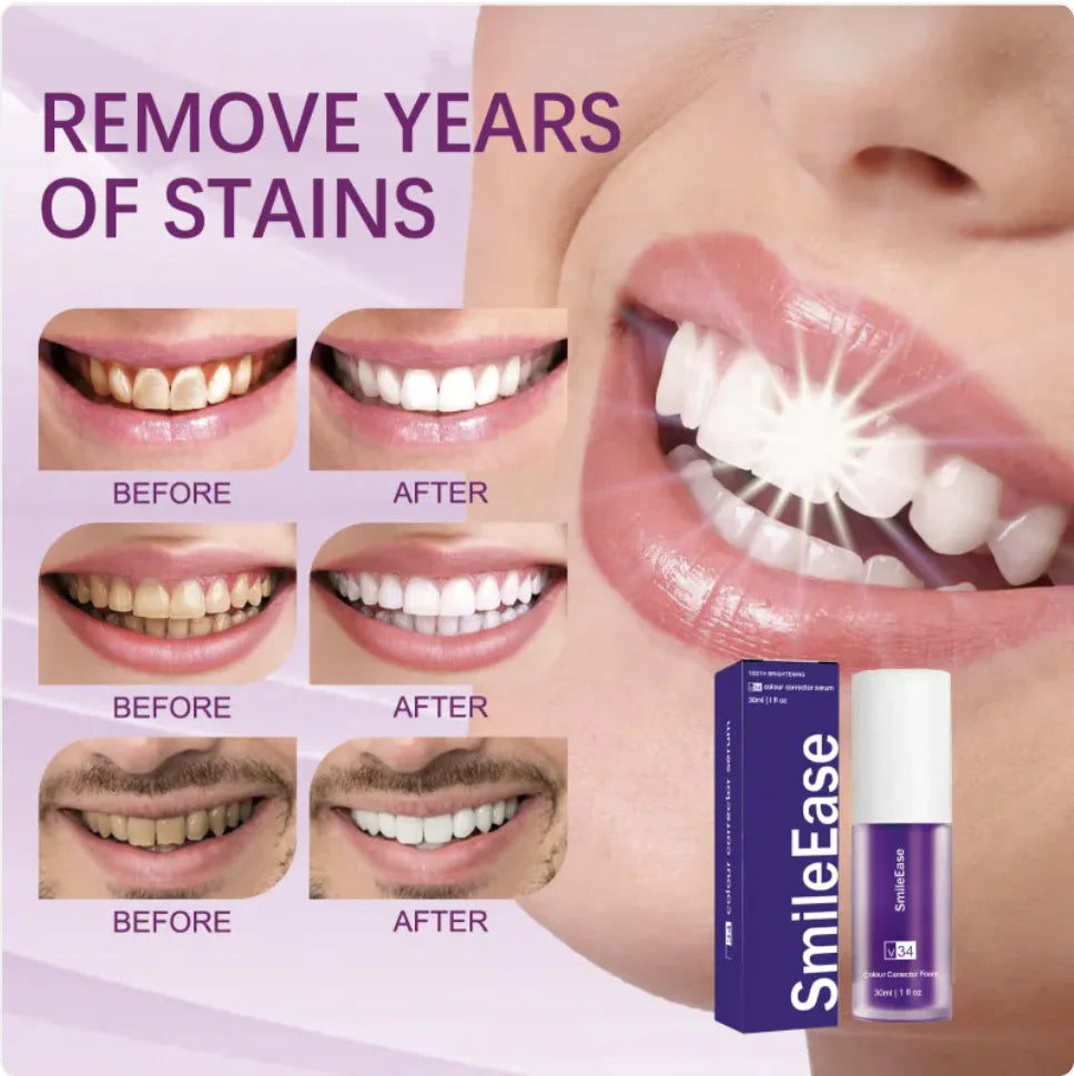 SmileEase V34 Purple Teeth Whitening Toothpaste
