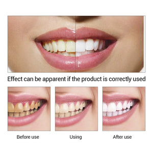 Teeth Whitening Rinse and Powder for Stains